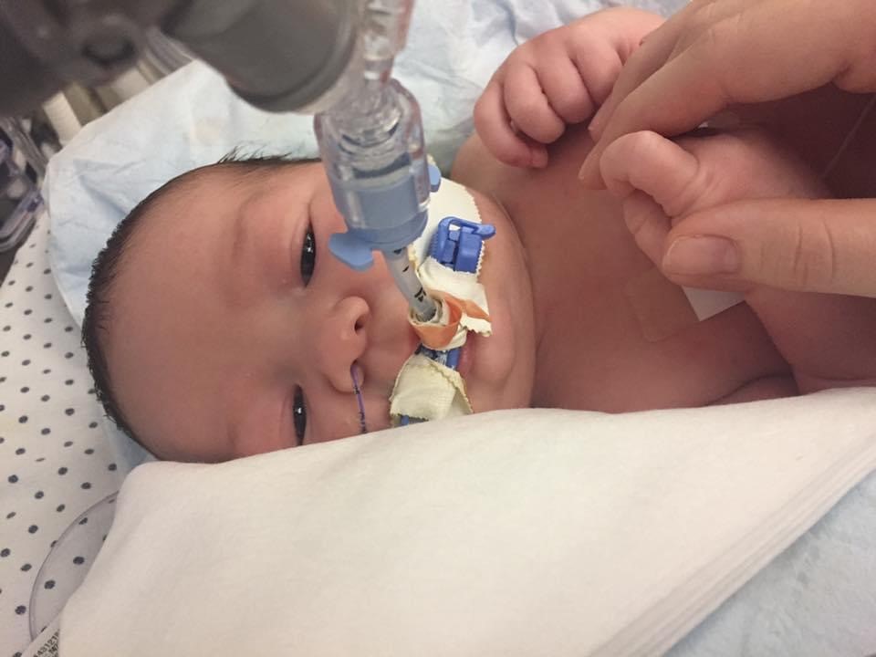 Levi as an infant while intubated.